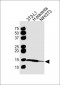 FABP4 Antibody